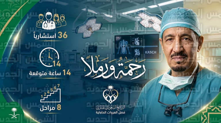 انطلاق عملية فصل التوأم الصومالي رحمة ورملا بمشاركة 36 خبيراً طبياً وتحديات صحية تصل خطورتها إلى 40%