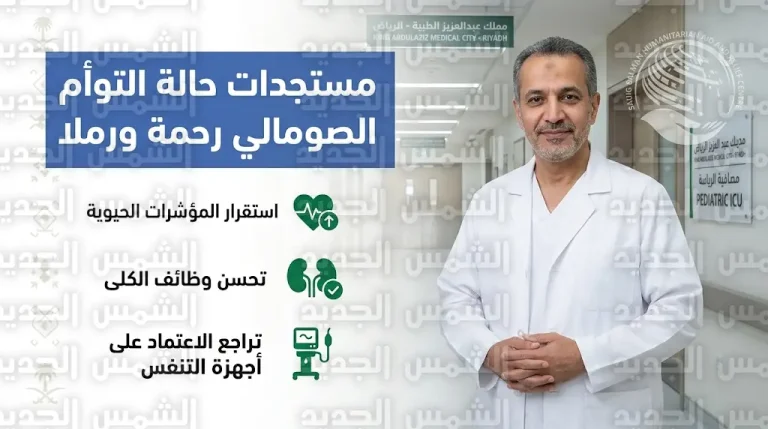 تطورات إيجابية في حالة الطفلة رحمة وبدء جلسات الغسيل الكلوي لشقيقتها رملا ضمن البرنامج السعودي للتوائم الملتصقة