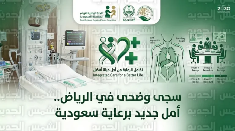 وصول التوأم الملتصق المغربي سجى وضحى إلى الرياض إنفاذاً لتوجيهات القيادة السعودية