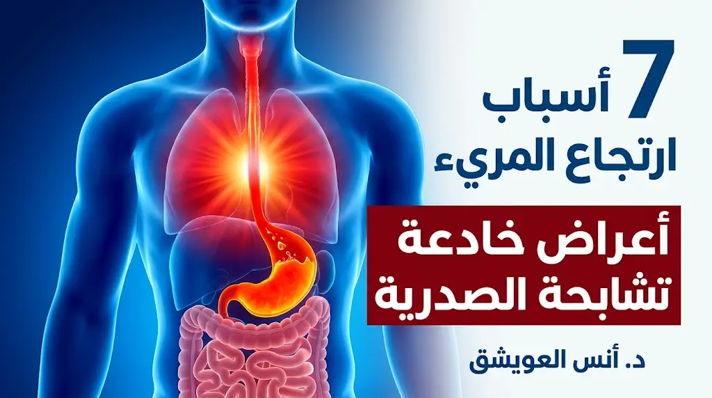 7 أسباب لارتجاع المريء.. استشاري يحذر: أعراضه خادعة وتشابه الذبحة الصدرية